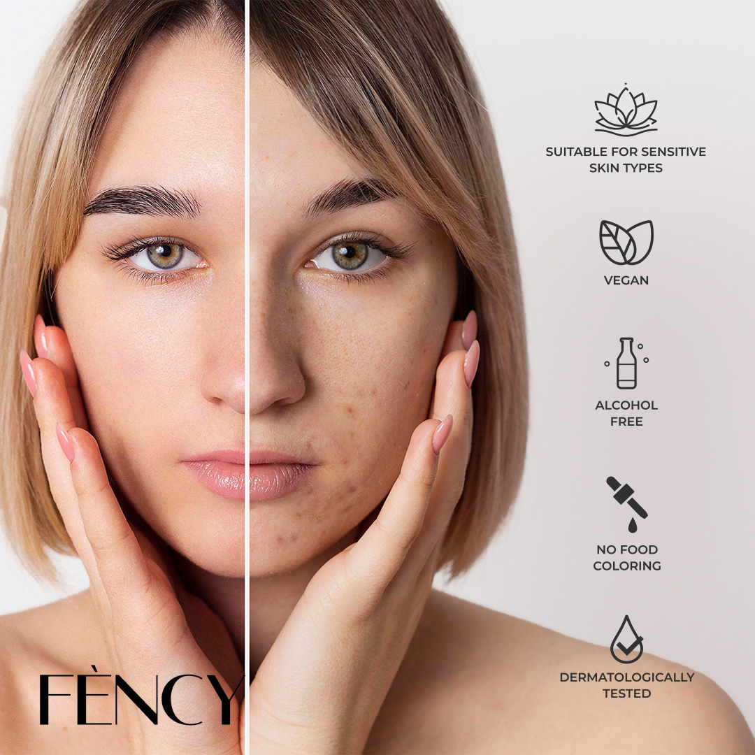 fency